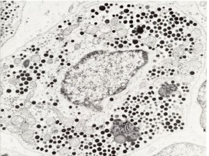 06- Classification of tumors